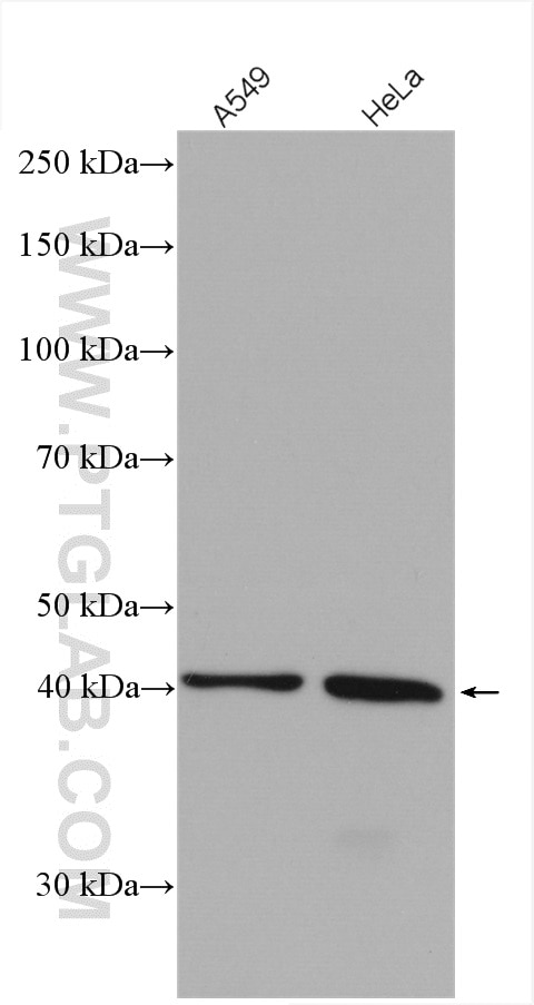 Western Blot (WB) analysis of various lysates using hIST1 Polyclonal antibody (51002-1-AP)