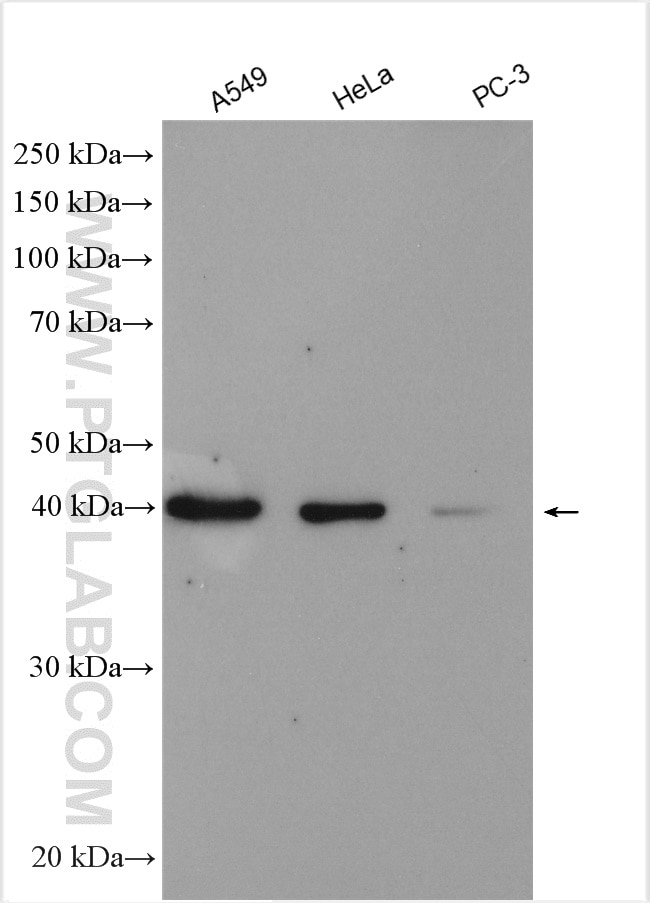 Western Blot (WB) analysis of various lysates using hIST1 Polyclonal antibody (51002-1-AP)