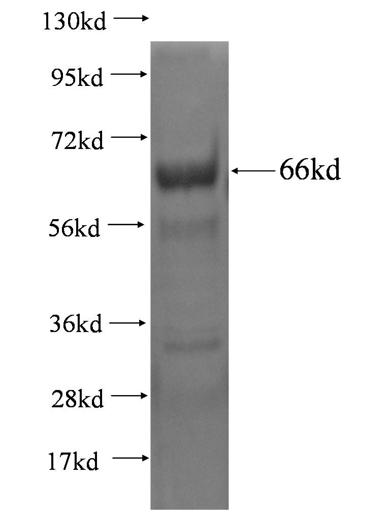 hIST1 fusion protein Ag0721 SDS-PAGE