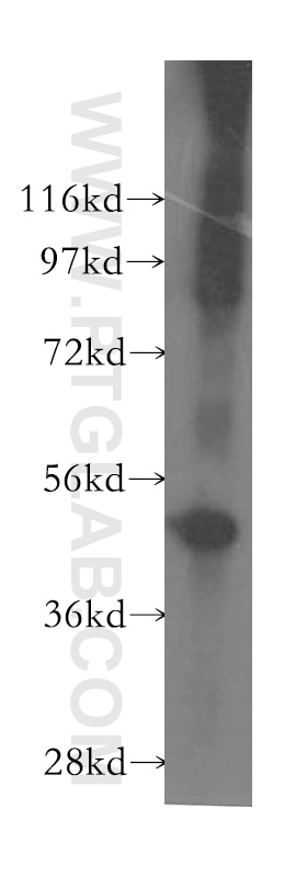 Western Blot (WB) analysis of human brain tissue using OLFM2 Polyclonal antibody (11997-1-AP)