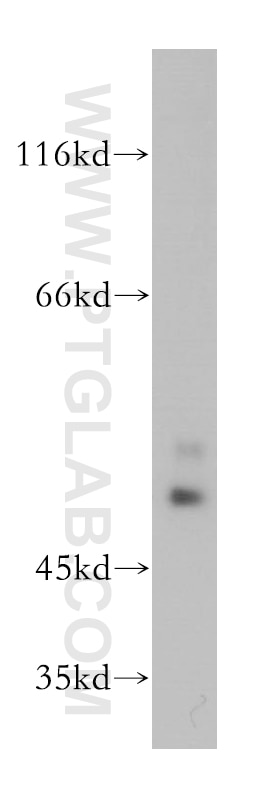 Western Blot (WB) analysis of human brain tissue using OLFM2 Polyclonal antibody (11997-1-AP)