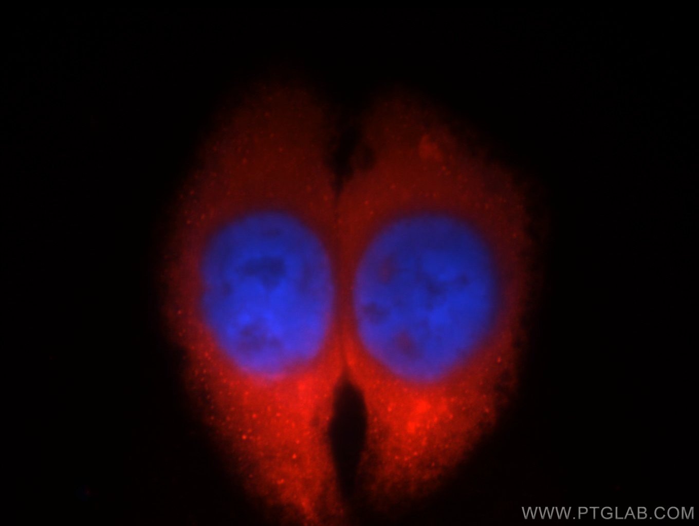 IF Staining of HepG2 using 12596-1-AP