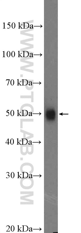 Western Blot (WB) analysis of PC-3 cells using OLFM3 Polyclonal antibody (12596-1-AP)