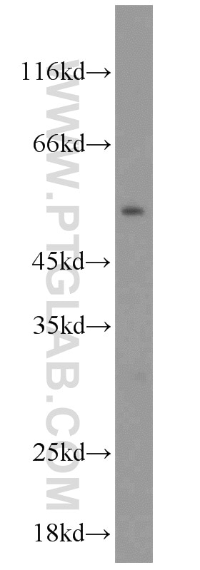 Western Blot (WB) analysis of mouse liver tissue using OLFM3 Polyclonal antibody (12596-1-AP)