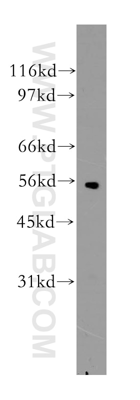Western Blot (WB) analysis of A2780 cells using OLFM3 Polyclonal antibody (12596-1-AP)