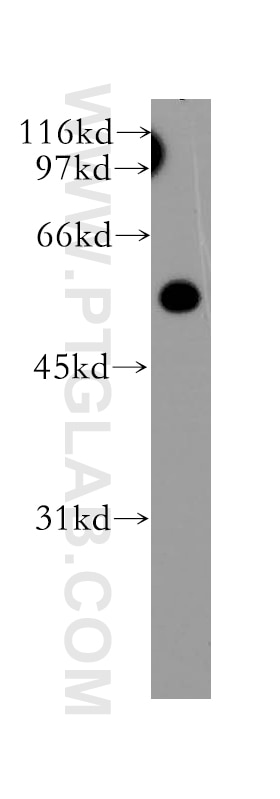 Western Blot (WB) analysis of human liver tissue using OLFM3 Polyclonal antibody (12596-1-AP)