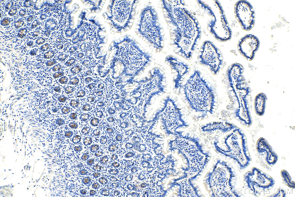 Immunohistochemistry (IHC) staining of human small intestine tissue using OLFM4 Polyclonal antibody (28432-1-AP)