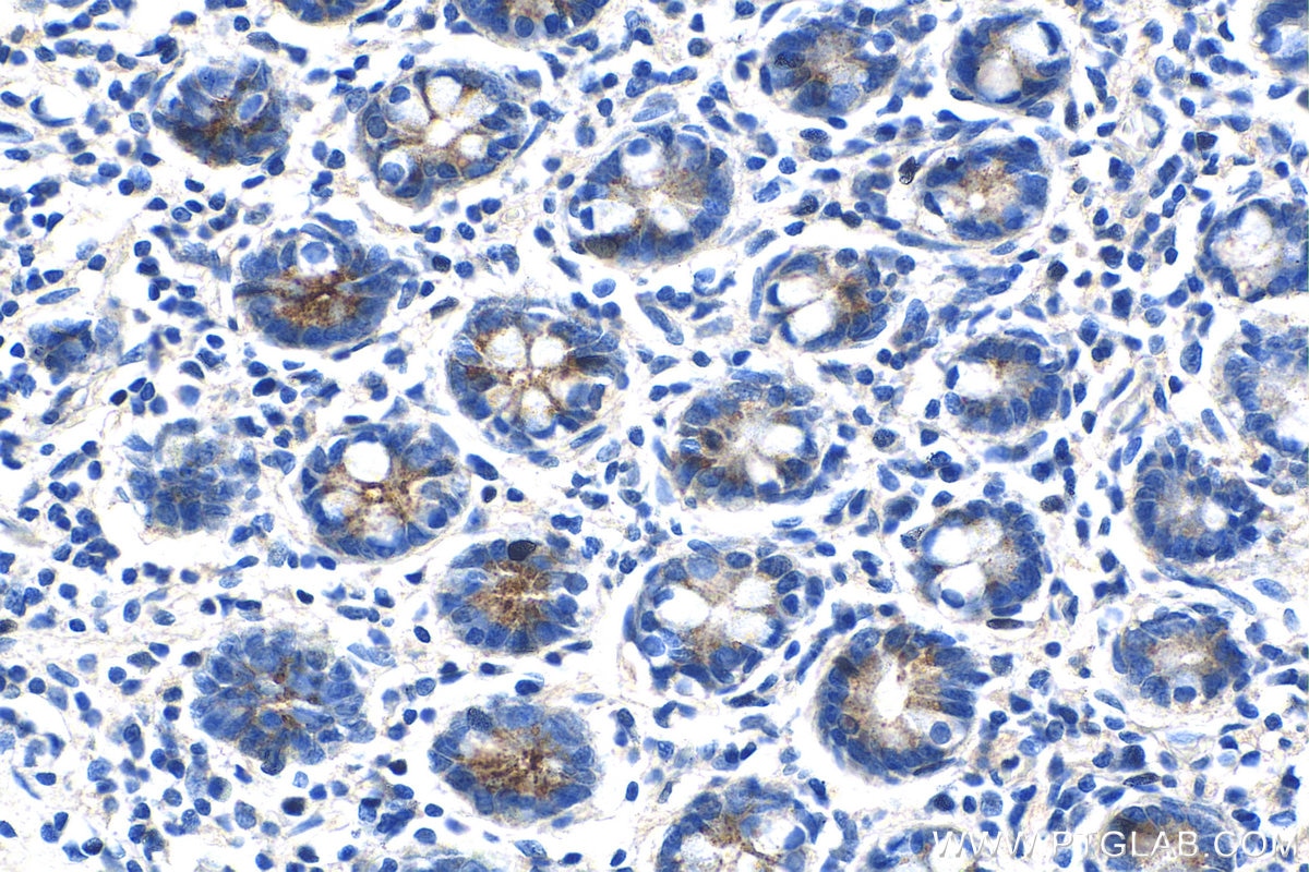Immunohistochemistry (IHC) staining of human small intestine tissue using OLFM4 Polyclonal antibody (28432-1-AP)