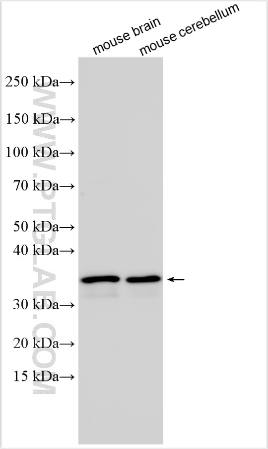 Western Blot (WB) analysis of various lysates using OLIG1 Polyclonal antibody (26763-1-AP)