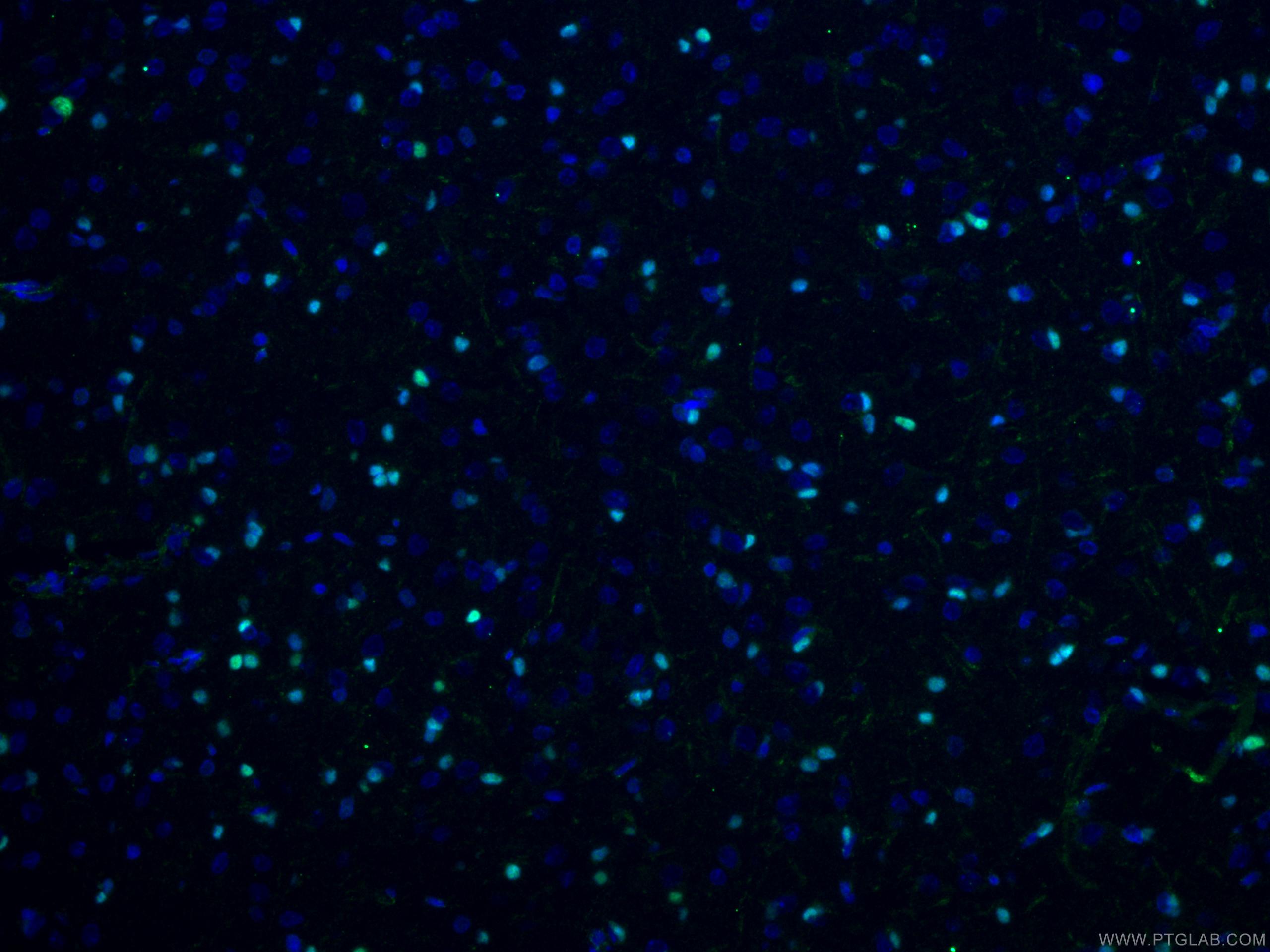 Immunofluorescence (IF) / fluorescent staining of rat brain tissue using OLIG2 Polyclonal antibody (13999-1-AP)