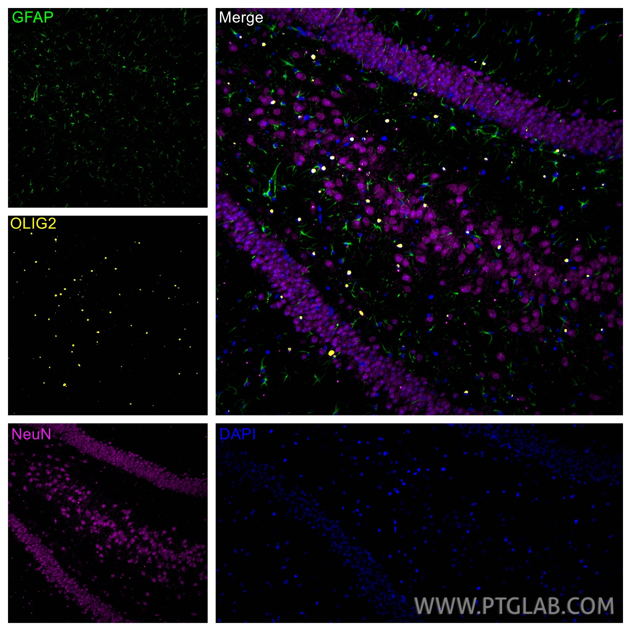Immunofluorescence (IF) / fluorescent staining of rat brain tissue using OLIG2 Polyclonal antibody (13999-1-AP)