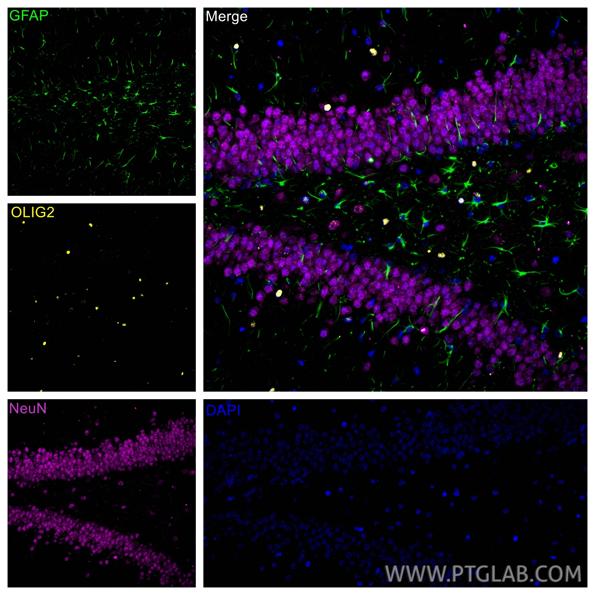 Immunofluorescence (IF) / fluorescent staining of rat brain tissue using OLIG2 Polyclonal antibody (13999-1-AP)