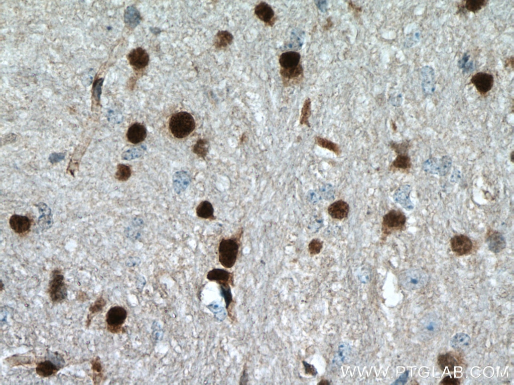 Immunohistochemistry (IHC) staining of mouse brain tissue using OLIG2 Polyclonal antibody (13999-1-AP)