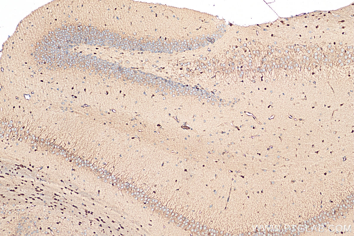 Immunohistochemistry (IHC) staining of mouse brain tissue using OLIG2 Polyclonal antibody (13999-1-AP)