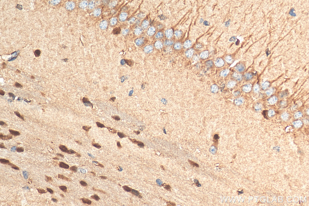 Immunohistochemistry (IHC) staining of mouse brain tissue using OLIG2 Polyclonal antibody (13999-1-AP)