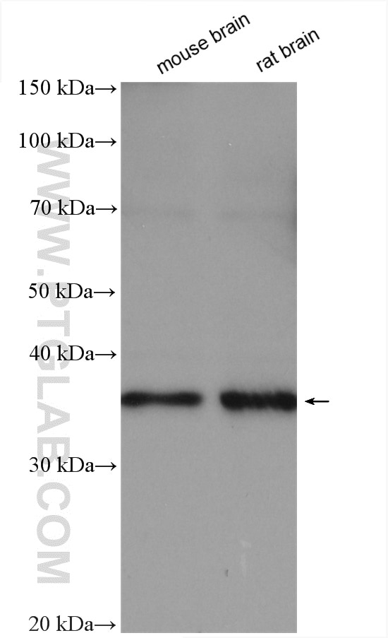 Western Blot (WB) analysis of various lysates using OLIG2 Polyclonal antibody (13999-1-AP)