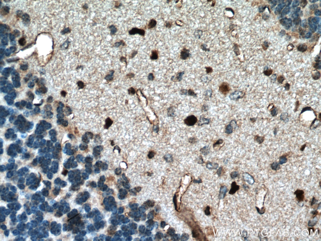 Immunohistochemistry (IHC) staining of mouse cerebellum tissue using OLIG2 Polyclonal antibody (25754-1-AP)