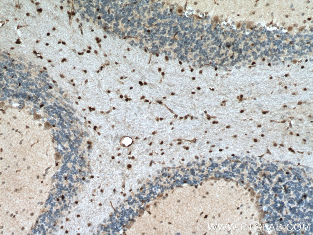 Immunohistochemistry (IHC) staining of mouse brain tissue using OLIG2 Polyclonal antibody (25754-1-AP)