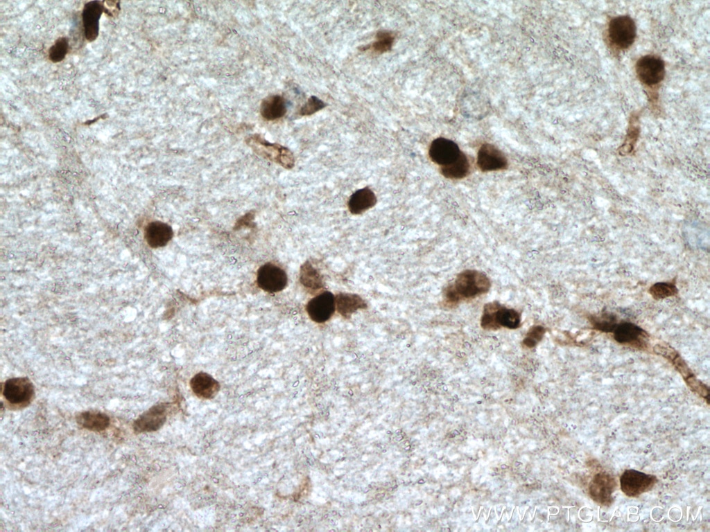 Immunohistochemistry (IHC) staining of mouse brain tissue using OLIG2 Polyclonal antibody (25754-1-AP)