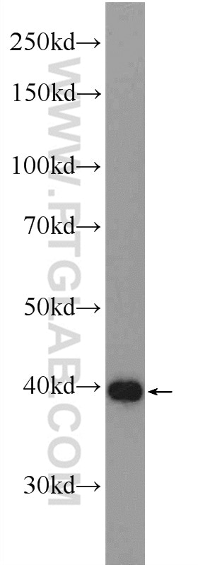 Western Blot (WB) analysis of rat brain tissue using OLIG2 Polyclonal antibody (25754-1-AP)