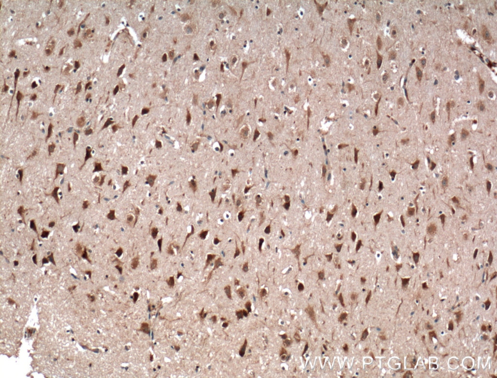 Immunohistochemistry (IHC) staining of human brain tissue using OLIG2 Monoclonal antibody (66513-1-Ig)