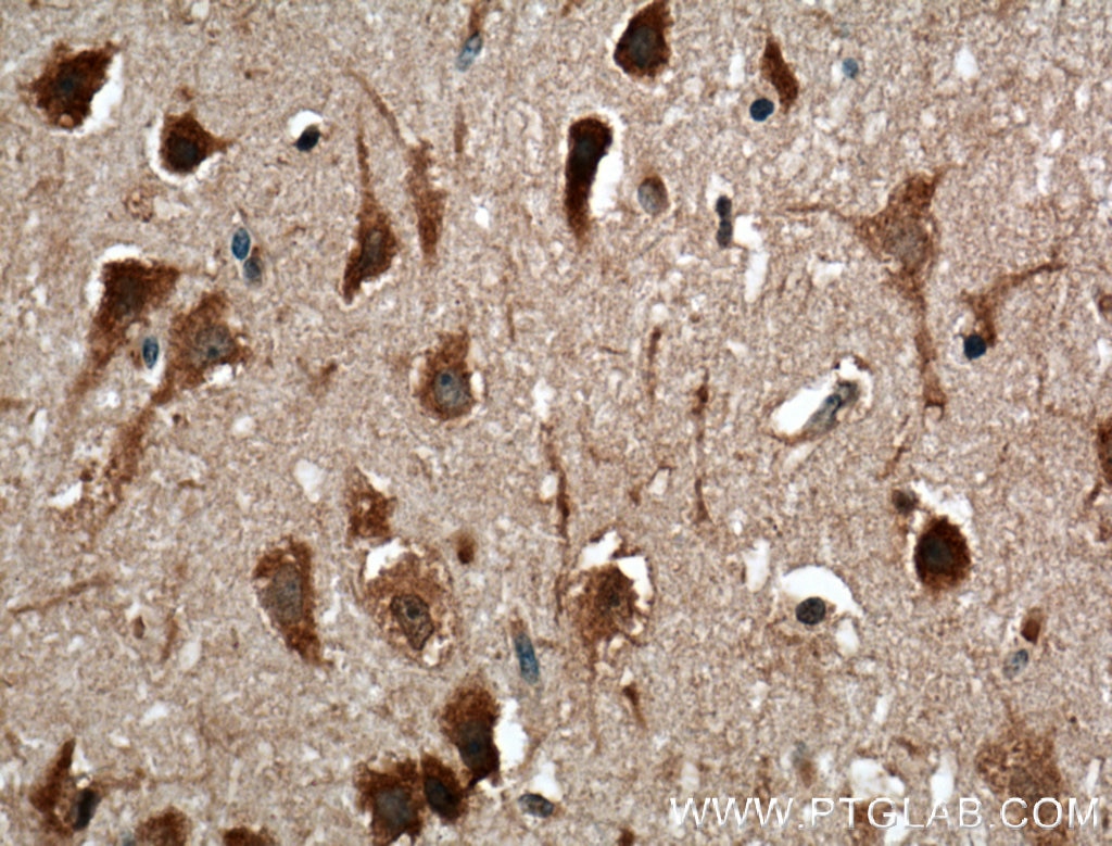 Immunohistochemistry (IHC) staining of human brain tissue using OLIG2 Monoclonal antibody (66513-1-Ig)