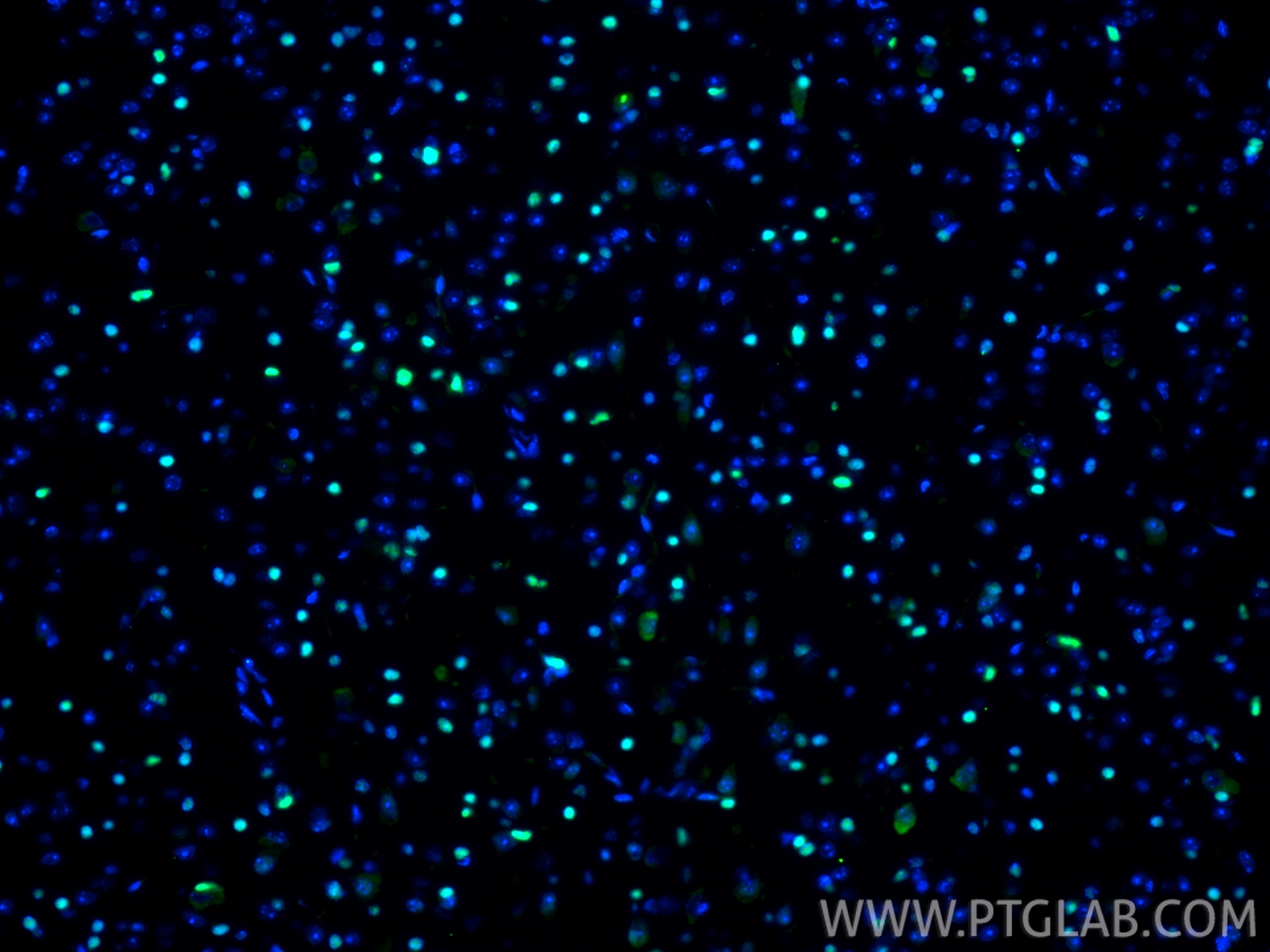 Immunofluorescence (IF) / fluorescent staining of mouse brain tissue using OLIG2 Recombinant antibody (82806-7-RR)