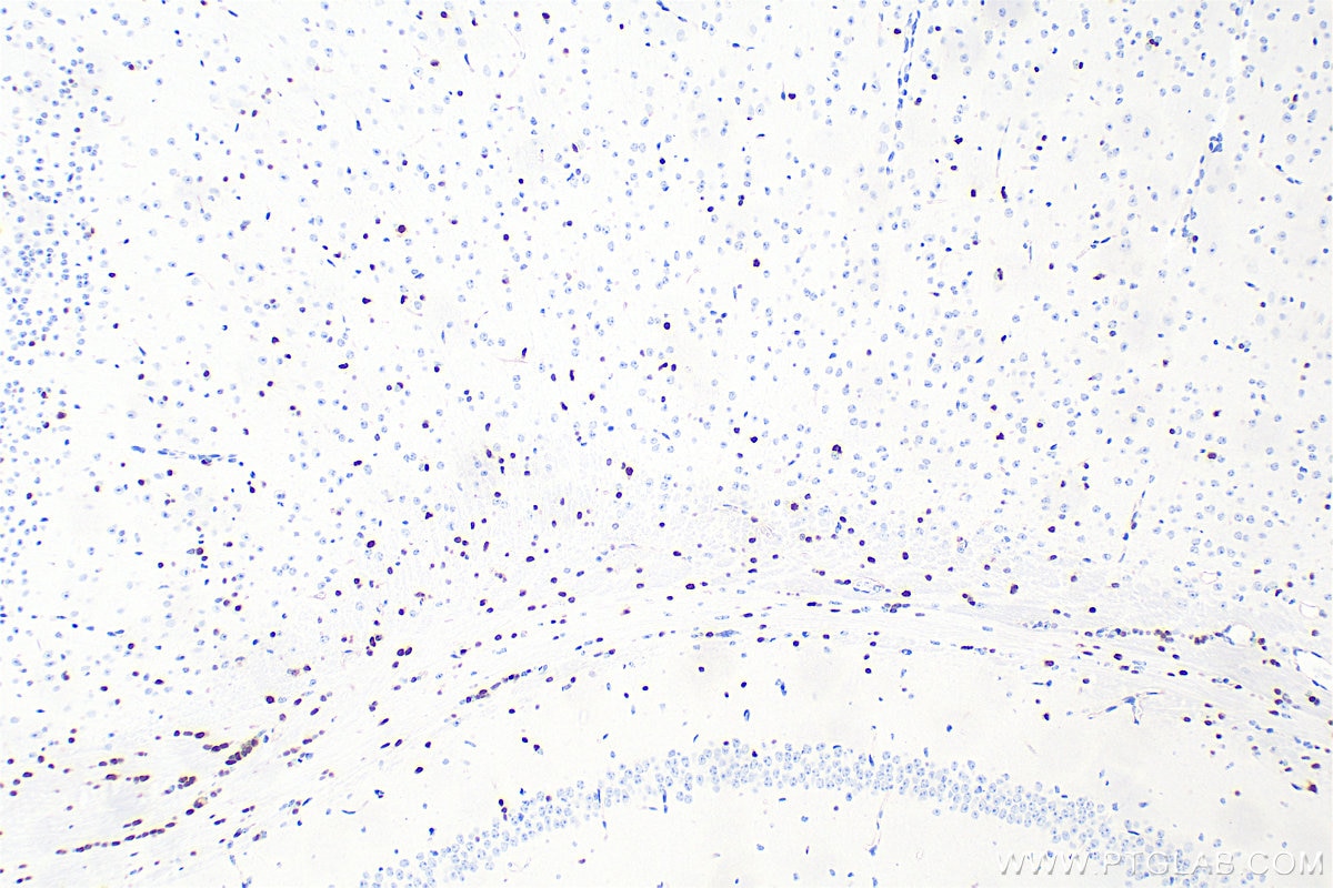 IHC staining of mouse brain using 82806-7-RR Immunohistochemistry (IHC) staining of mouse brain tissue using OLIG2 Recombinant monoclonal antibody (82806-7-RR)