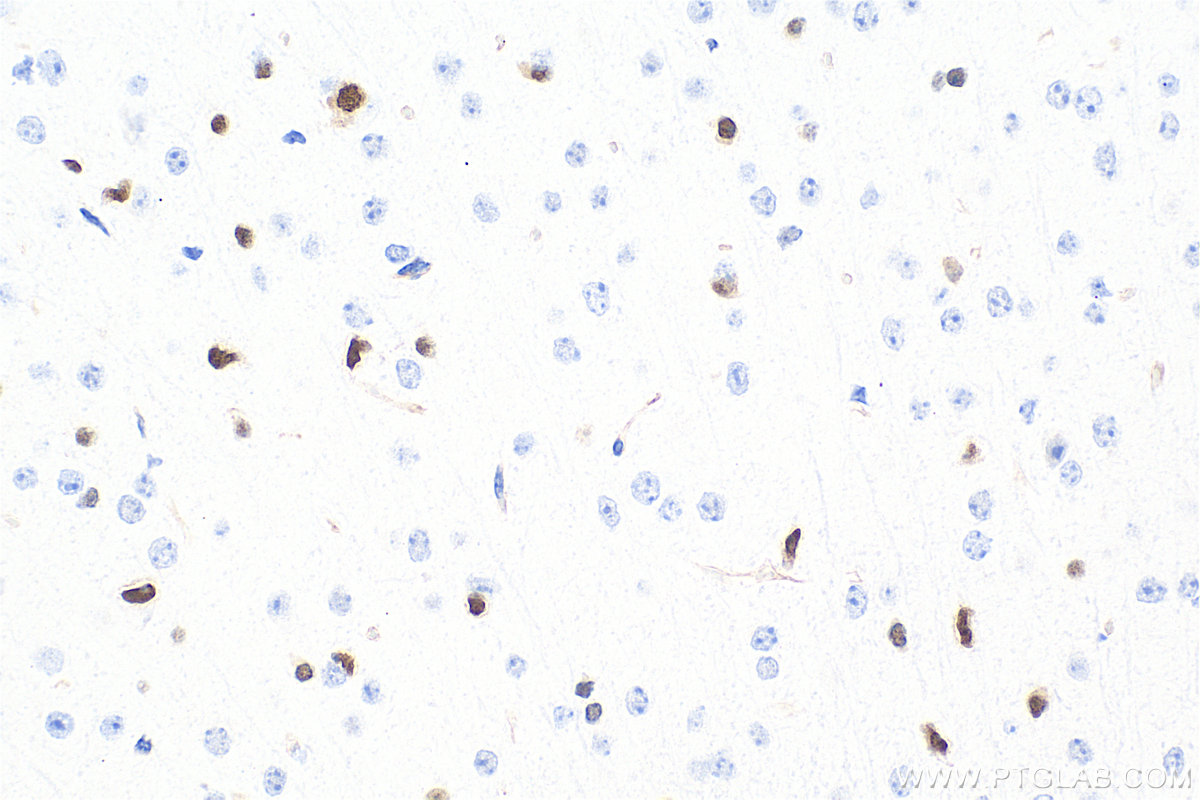 IHC staining of mouse brain using 82806-7-RR Immunohistochemistry (IHC) staining of mouse brain tissue using OLIG2 Recombinant monoclonal antibody (82806-7-RR)