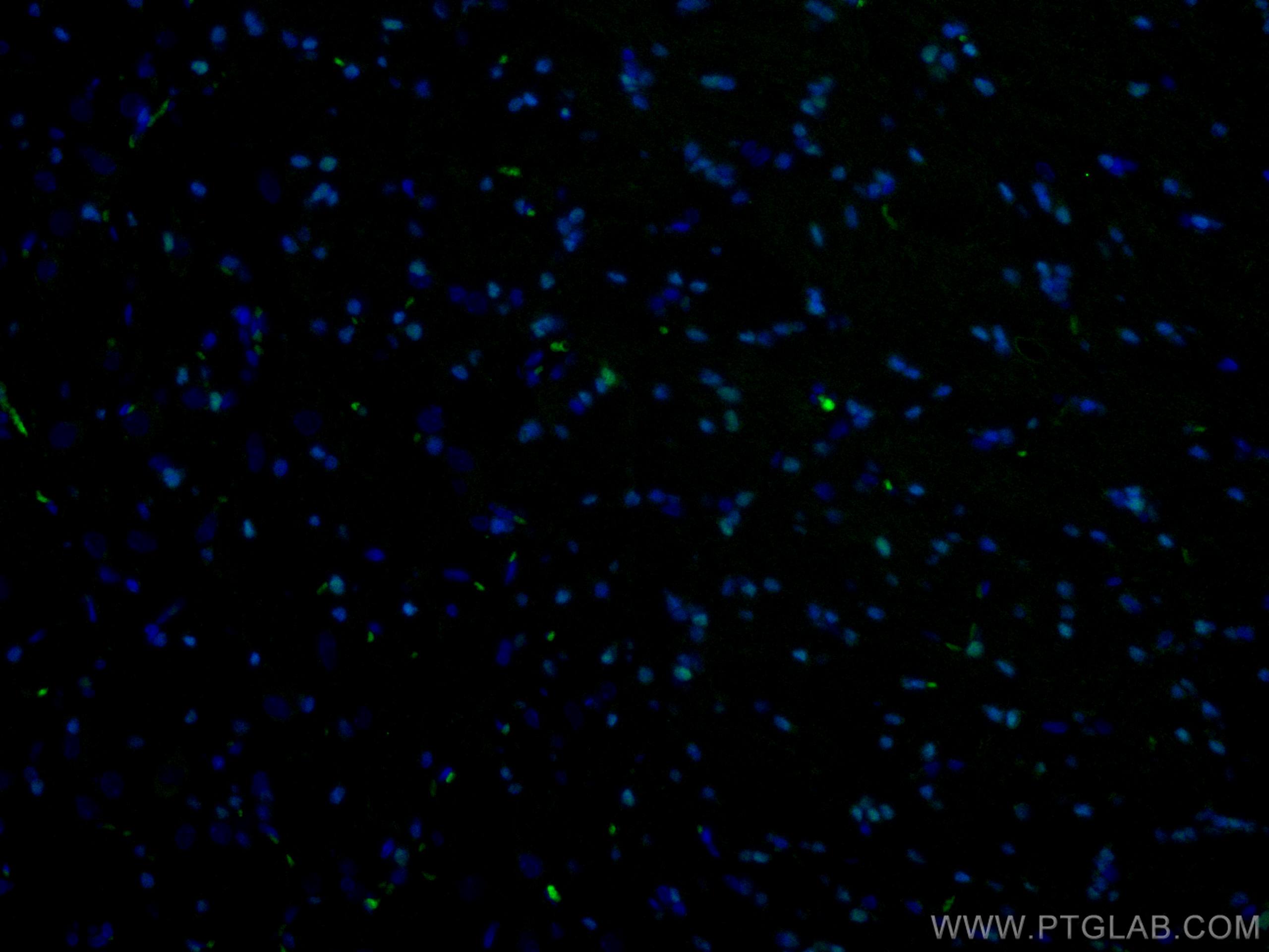 IF Staining of rat brain using CL488-13999