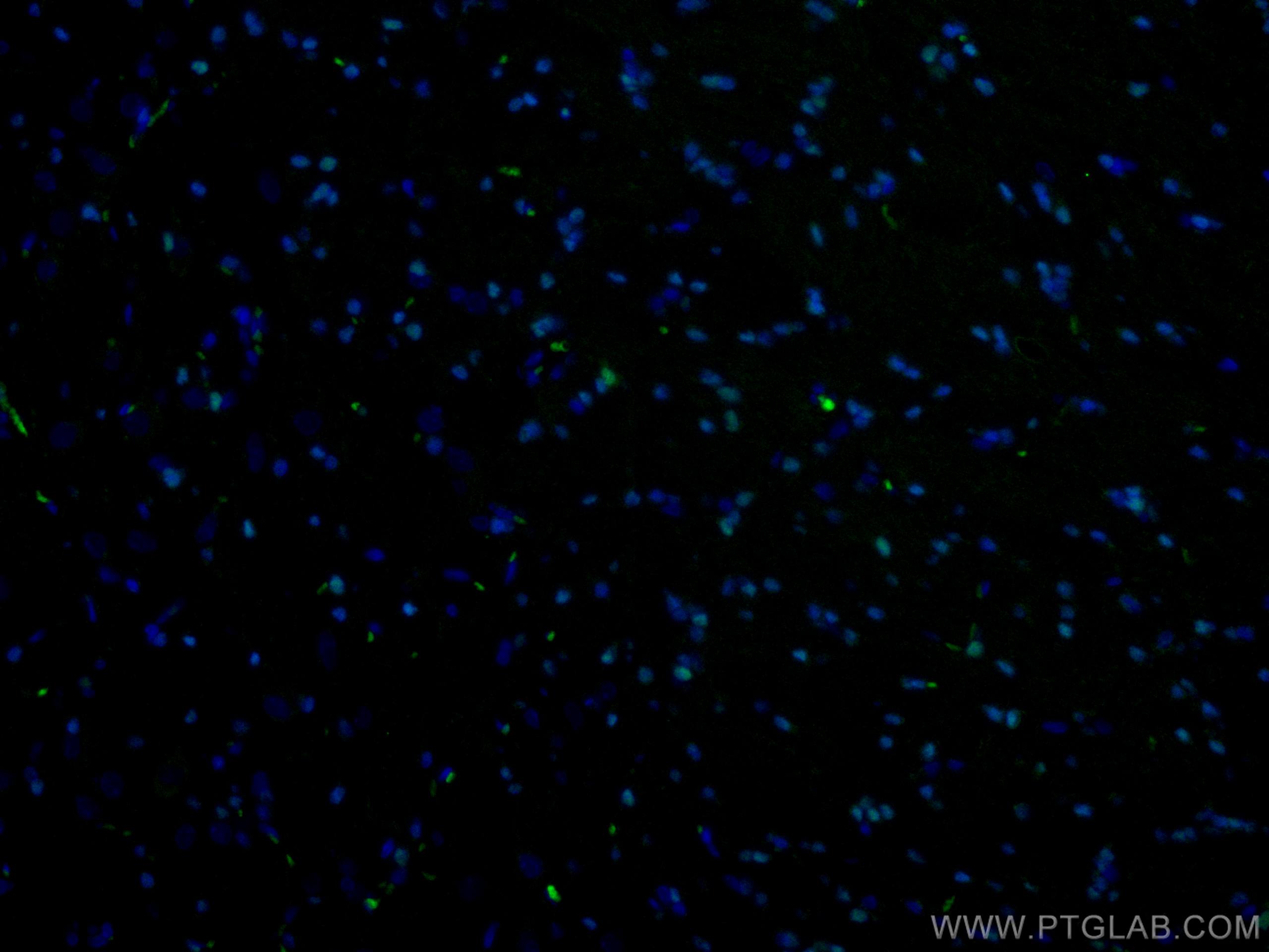 Immunofluorescence (IF) / fluorescent staining of rat brain tissue using CoraLite® Plus 488-conjugated OLIG2 Polyclonal ant (CL488-13999)