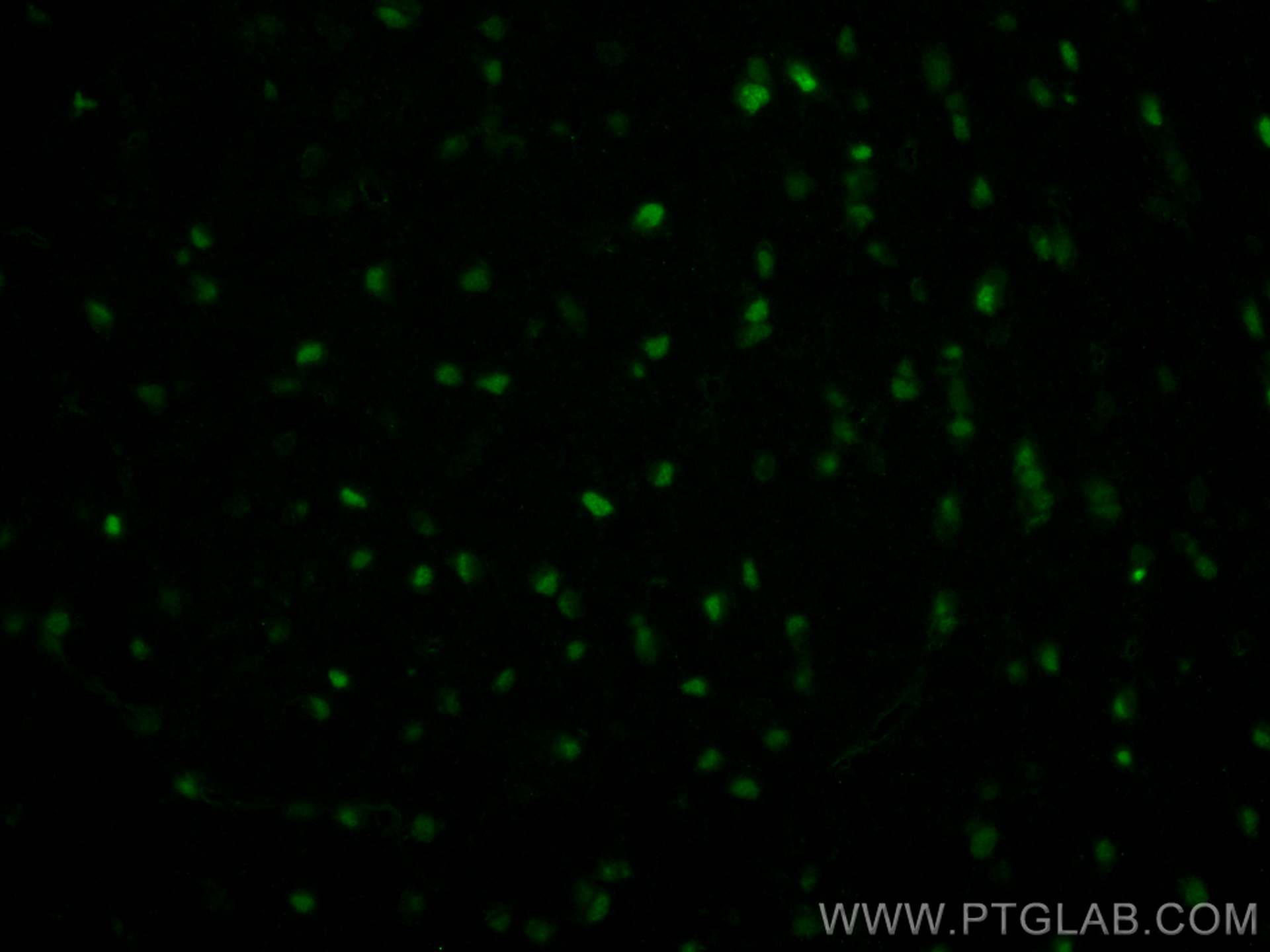 Immunofluorescent analysis of (4% PFA) fixed paraffin-embedded rat brain tissue using CoraLite® Plus 488 OLIG2 antibody (CL488-13999) at dilution of 1:200. Heat mediated antigen retrieval with Tris-EDTA buffer (pH 9.0). Immunofluorescence (IF) / fluorescent staining of rat brain tissue using CoraLite® Plus 488-conjugated OLIG2 Polyclonal ant (CL488-13999)