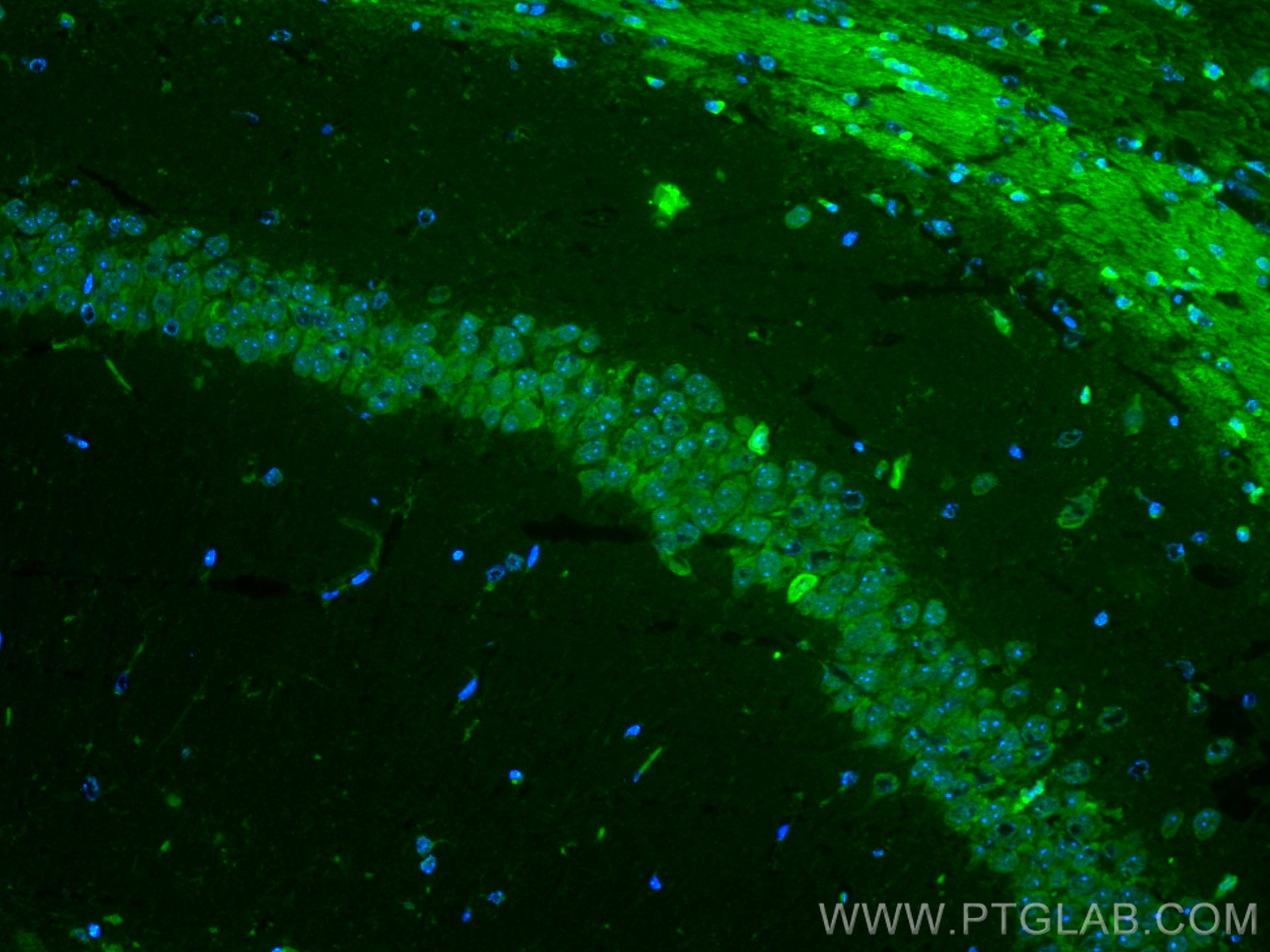 Immunofluorescence (IF) / fluorescent staining of mouse brain tissue using CoraLite® Plus 488-conjugated OLIG2 Monoclonal ant (CL488-66513)