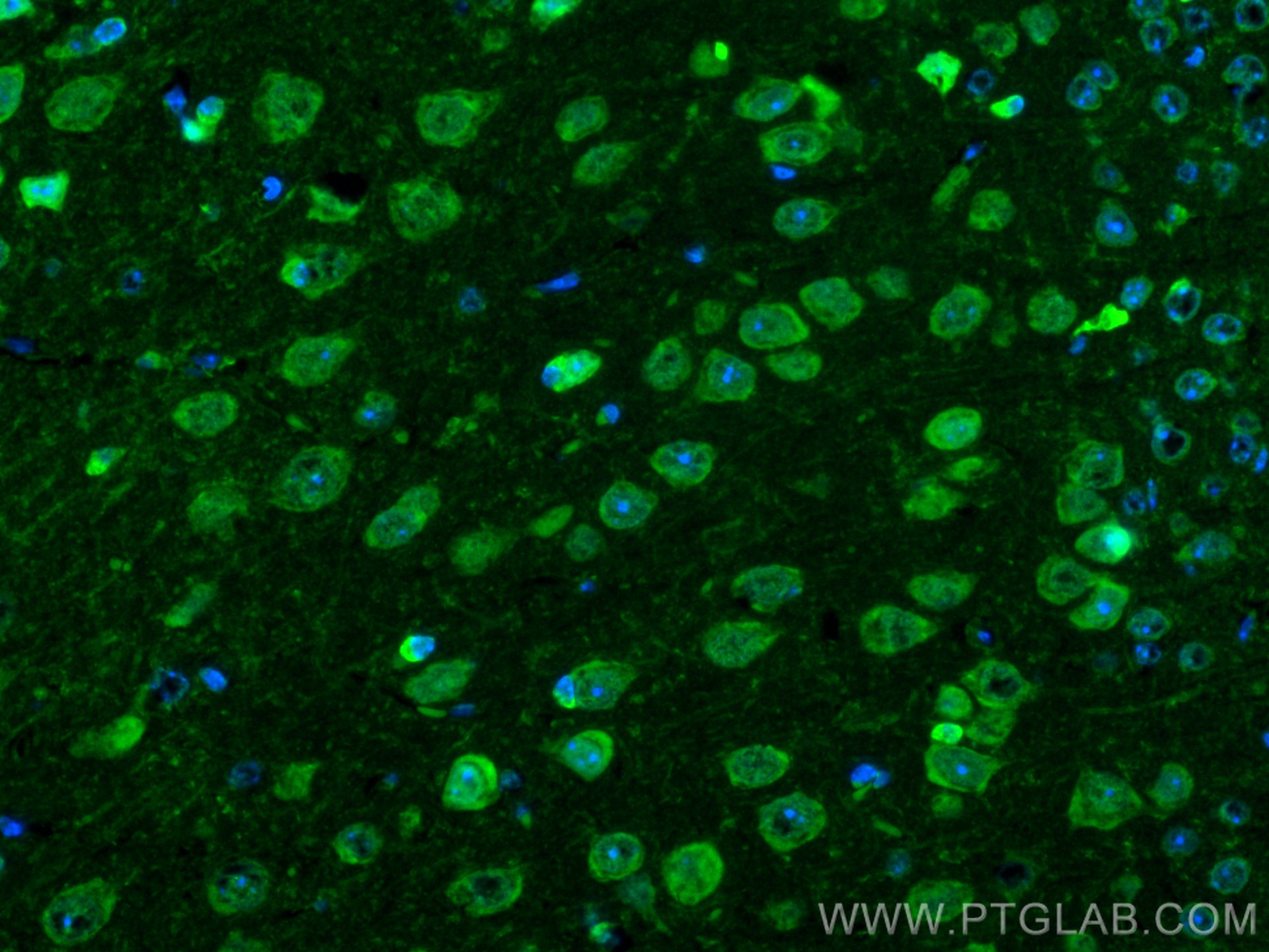 Immunofluorescence (IF) / fluorescent staining of mouse brain tissue using CoraLite® Plus 488-conjugated OLIG2 Monoclonal ant (CL488-66513)