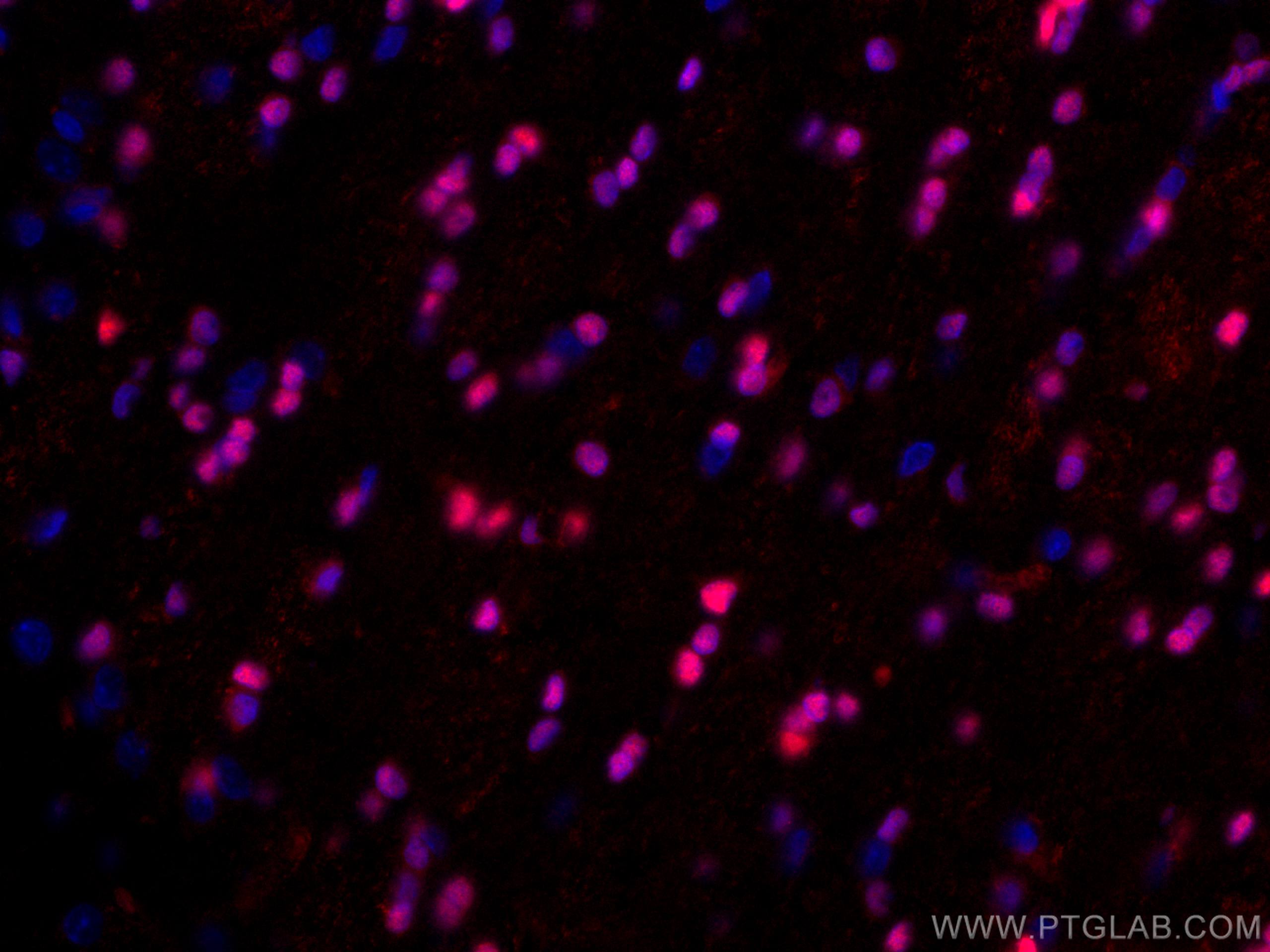 Immunofluorescence (IF) / fluorescent staining of rat brain tissue using CoraLite®594-conjugated OLIG2 Polyclonal antibody (CL594-13999)