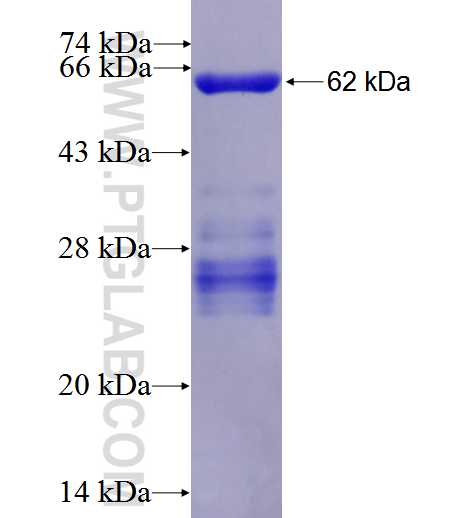 OLIG2 fusion protein Ag5089 SDS-PAGE