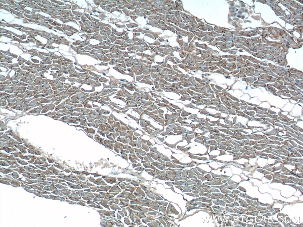 Immunohistochemistry (IHC) staining of human heart tissue using OLR1 Polyclonal antibody (11837-1-AP)