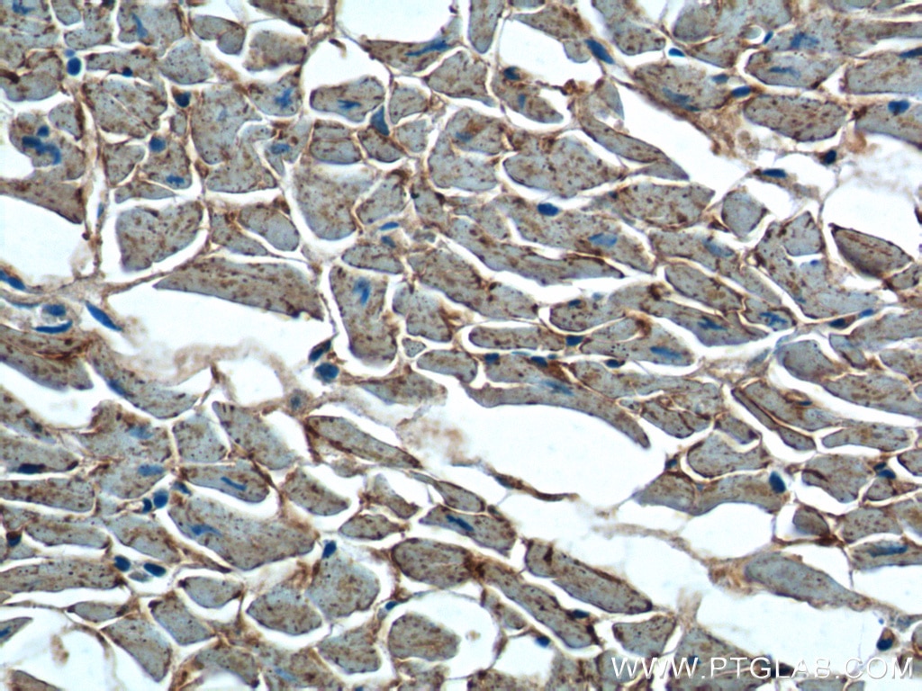 IHC staining of human heart using 11837-1-AP