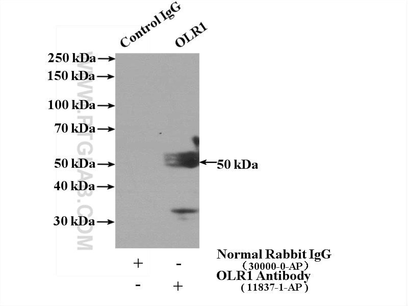 Immunoprecipitation (IP) experiment of L02 cells using OLR1 Polyclonal antibody (11837-1-AP)