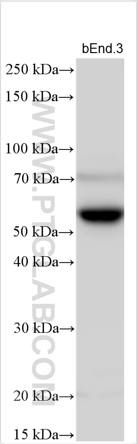 Western Blot (WB) analysis of various lysates using OLR1 Polyclonal antibody (11837-1-AP)