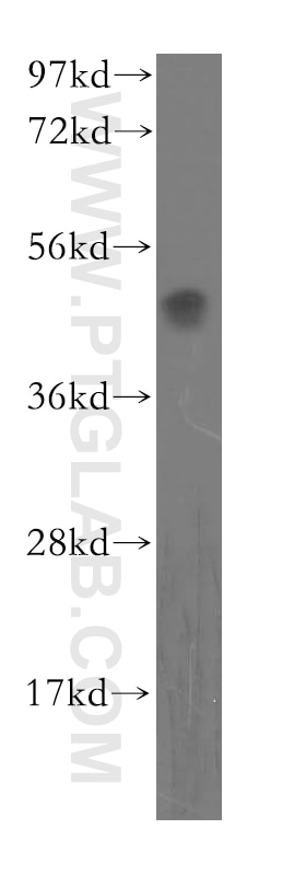 Western Blot (WB) analysis of human liver tissue using OLR1 Polyclonal antibody (11837-1-AP)