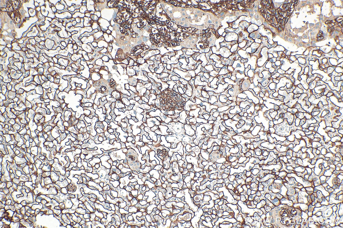 IHC staining of mouse placenta using 32685-1-AP Immunohistochemistry (IHC) staining of mouse placenta tissue using OLR1/LOX1 Polyclonal antibody (32685-1-AP)
