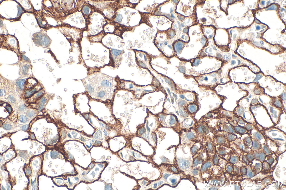 IHC staining of mouse placenta using 32685-1-AP Immunohistochemistry (IHC) staining of mouse placenta tissue using OLR1/LOX1 Polyclonal antibody (32685-1-AP)