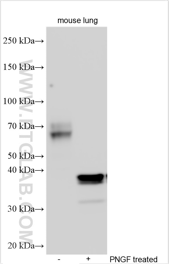 WB analysis using 32685-1-AP Western Blot (WB) analysis of various lysates using OLR1/LOX1 Polyclonal antibody (32685-1-AP)