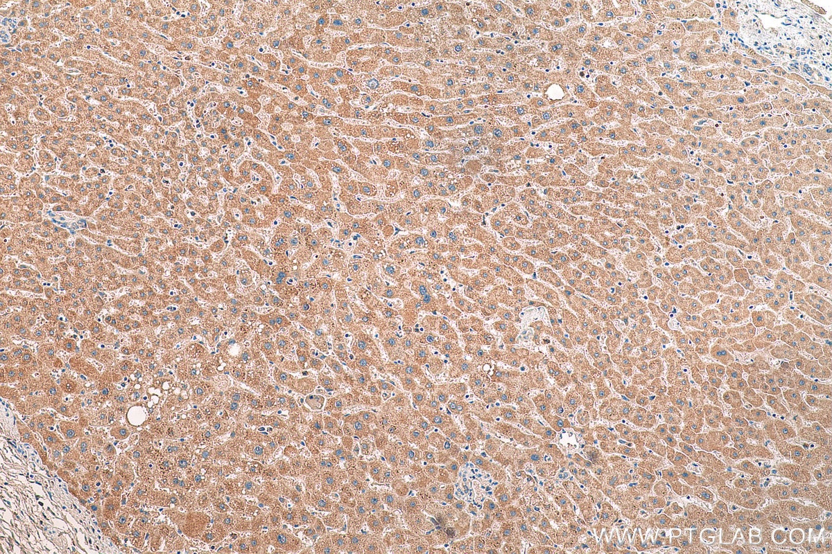 Immunohistochemistry (IHC) staining of human liver tissue using OMA1 Polyclonal antibody (17116-1-AP)