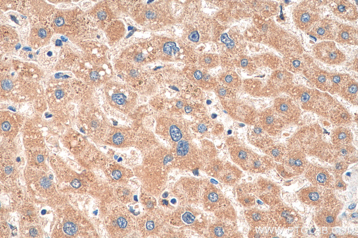 IHC staining of human liver using 17116-1-AP