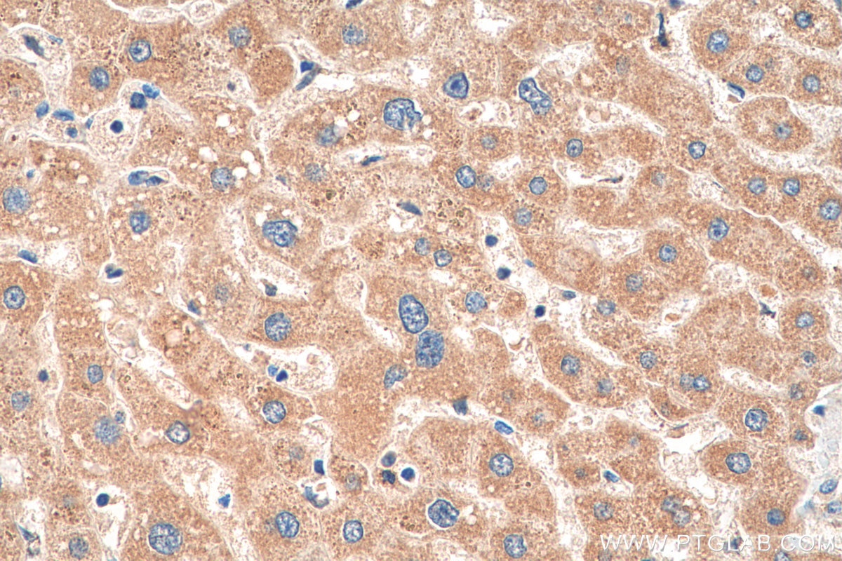 Immunohistochemistry (IHC) staining of human liver tissue using OMA1 Polyclonal antibody (17116-1-AP)