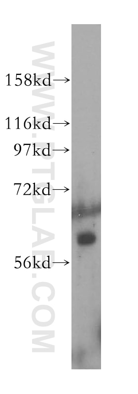 Western Blot (WB) analysis of K-562 cells using OMA1 Polyclonal antibody (17116-1-AP)
