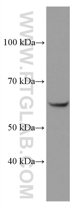 Western Blot (WB) analysis of LNCaP cells using OMA1 Monoclonal antibody (67449-1-Ig)