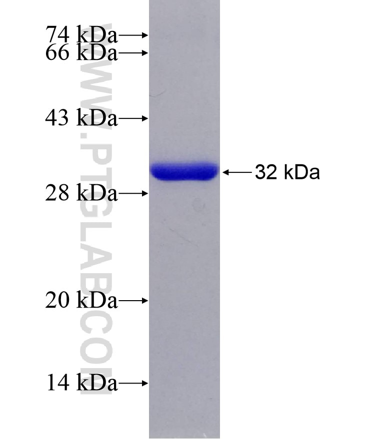OMA1 fusion protein Ag29202 SDS-PAGE